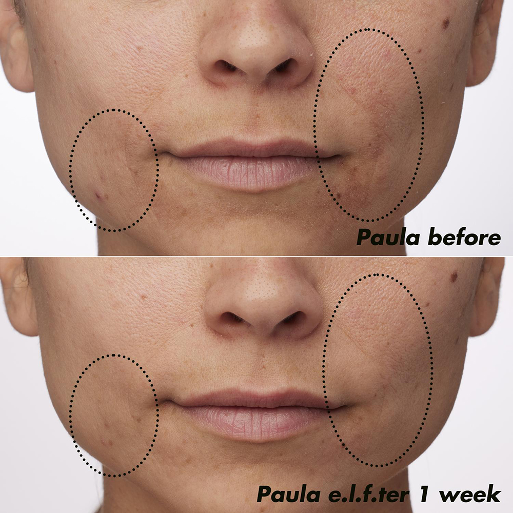 E.L.F. SKIN PLZ CLARIFY FACIAL OIL (ACEITE FACIAL)